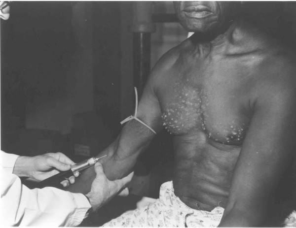 male_blood_test-600x463